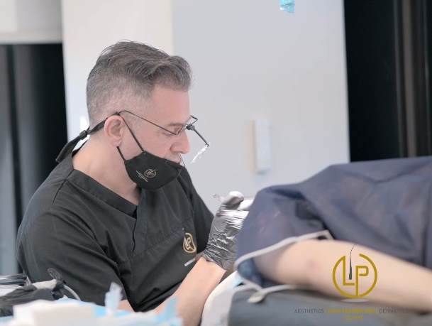 Μεταμόσχευση Μαλλιών τρίτο στάδιο - LP Clinic